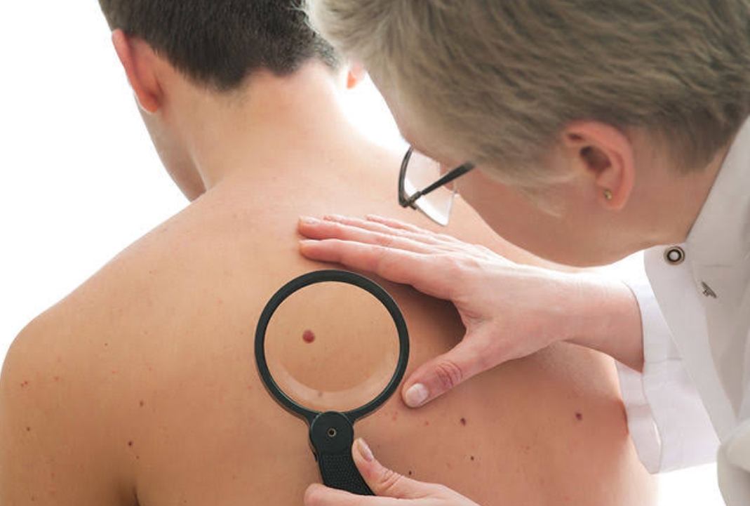 Guiding Light: The Role of a Skin Cancer Clinic in Safeguarding Your Health