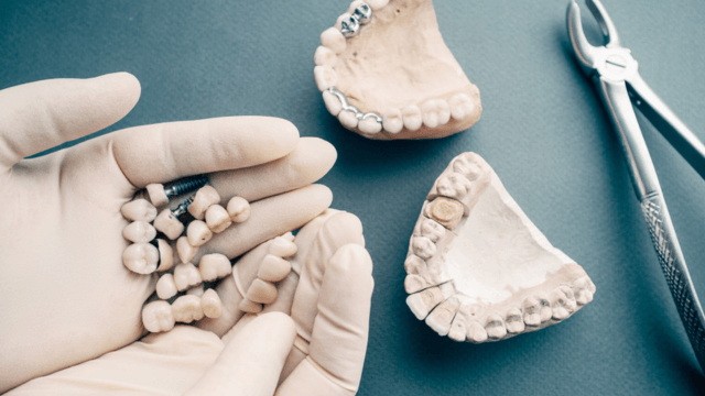 Bridging Gaps, Building Smiles: Exploring Dental Bridge Innovations