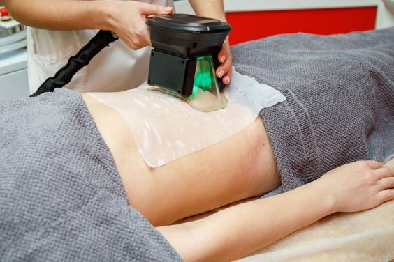 Sculpting Confidence: Fat Freezing in Dubai at Lavish Clinic