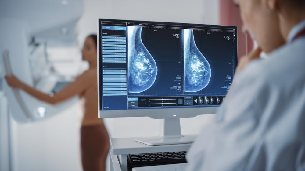 The Significance Of Mammography In Breast Cancer Diagnosis And Treatment