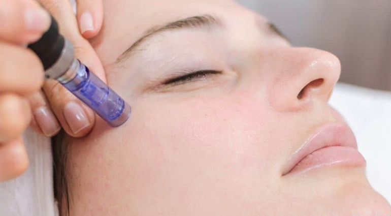 The Magic Of Skin Needling: A Deep Dive Into Microneedling For Healthy Glowing Skin