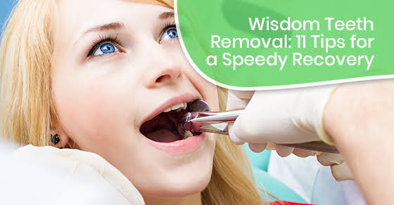 Recovery Tips and Tricks: Your Post-Op Checklist After Wisdom Teeth Removal
