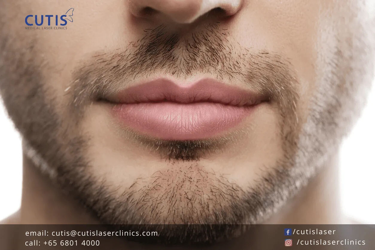 7 Lip Filler Shapes to Enhance Your Natural Lip Symmetry