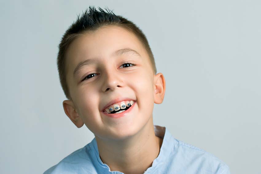 Decoding Orthodontic Expenses: How Much Do Braces Cost in California