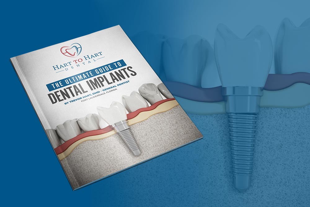 The Ultimate Guide to Dental Implants in Stuart FL