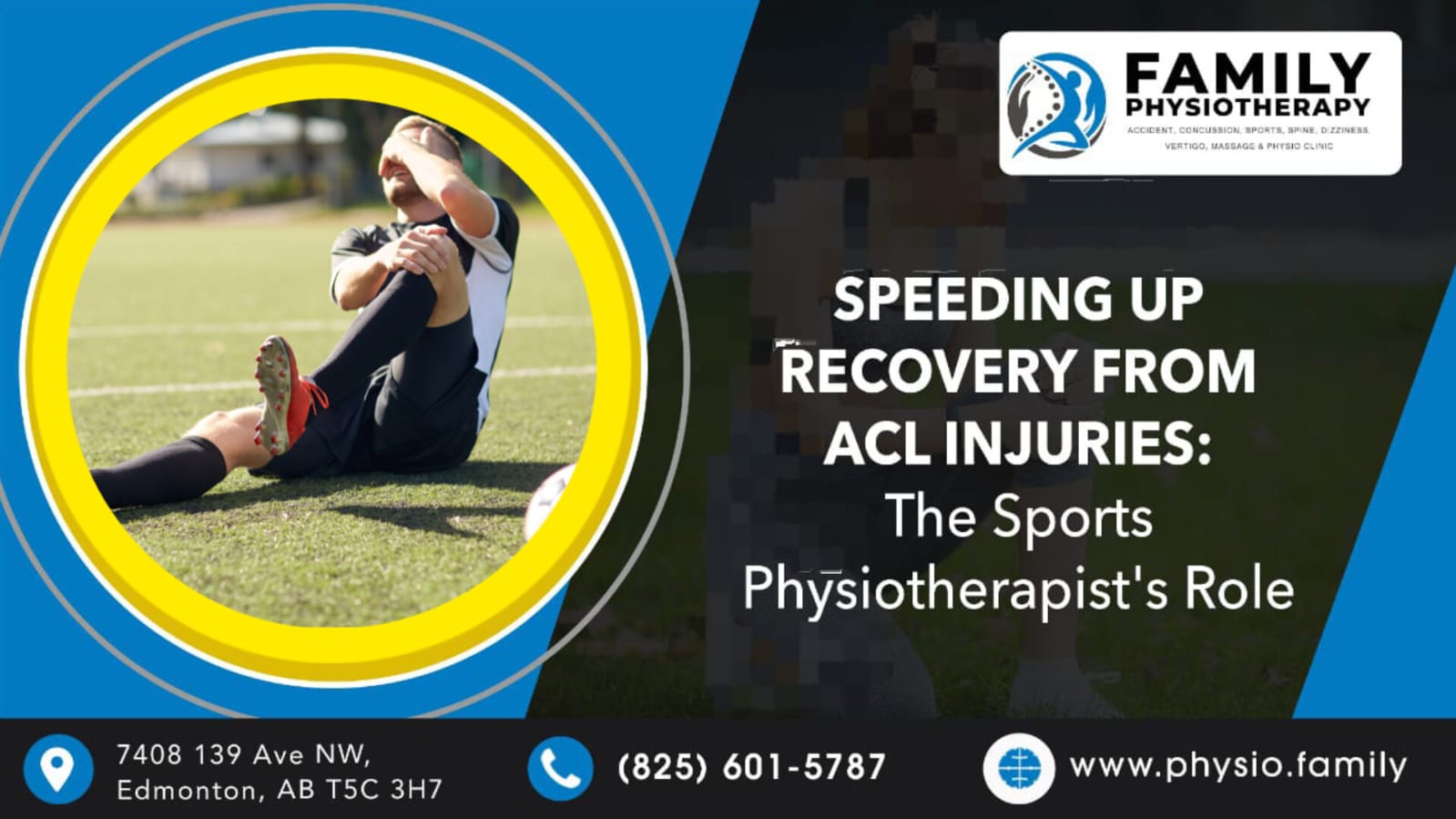 Speeding Up Recovery from ACL Injuries: The Sports Physiotherapist’s Role