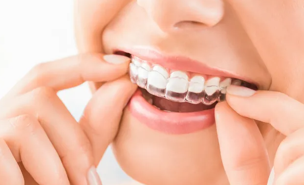 A Comprehensive Guide to Invisalign: The Clear Alternative to Braces in Chicago