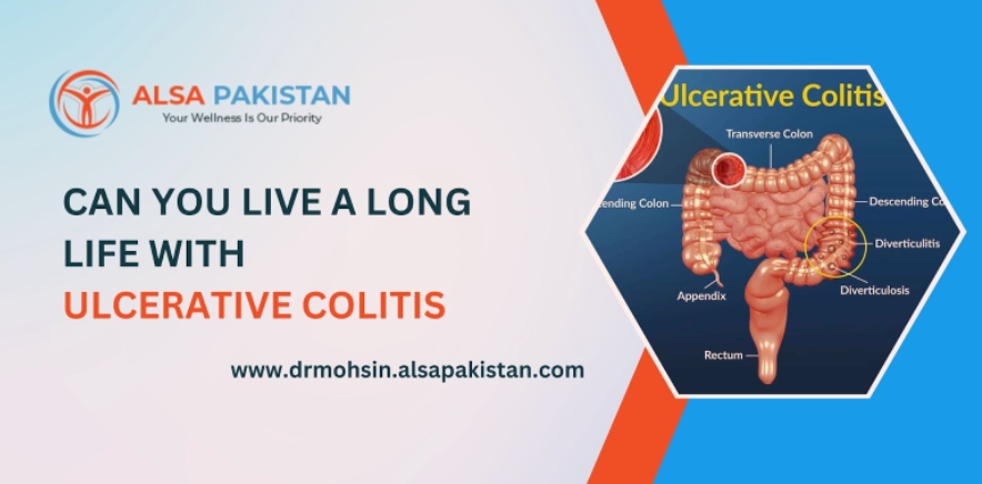 Can you live a long life with ulcerative colitis?