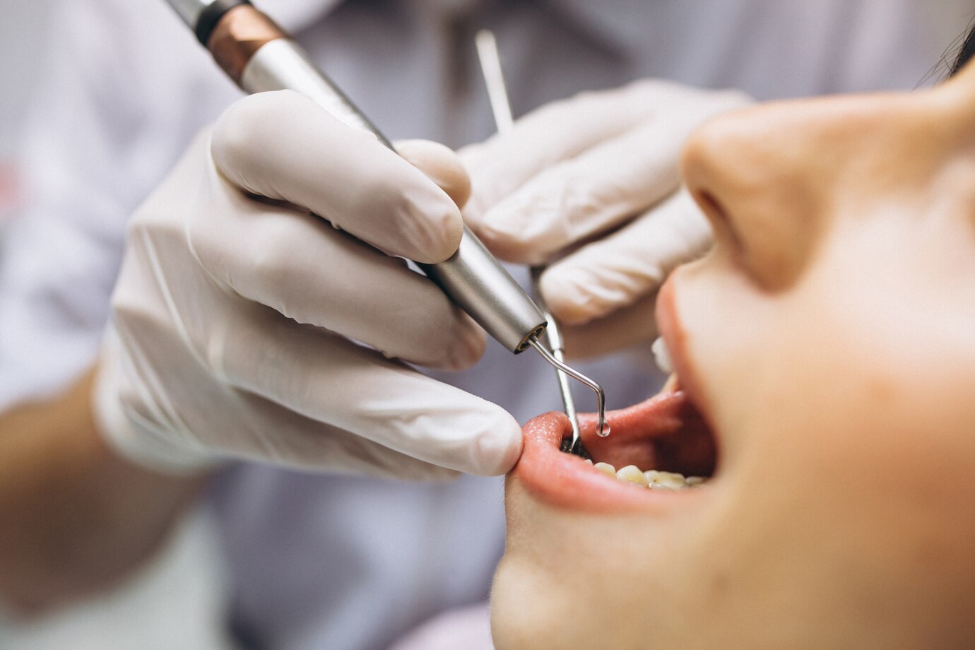 Navigating Wisdom Tooth Extraction: A Comprehensive Guide