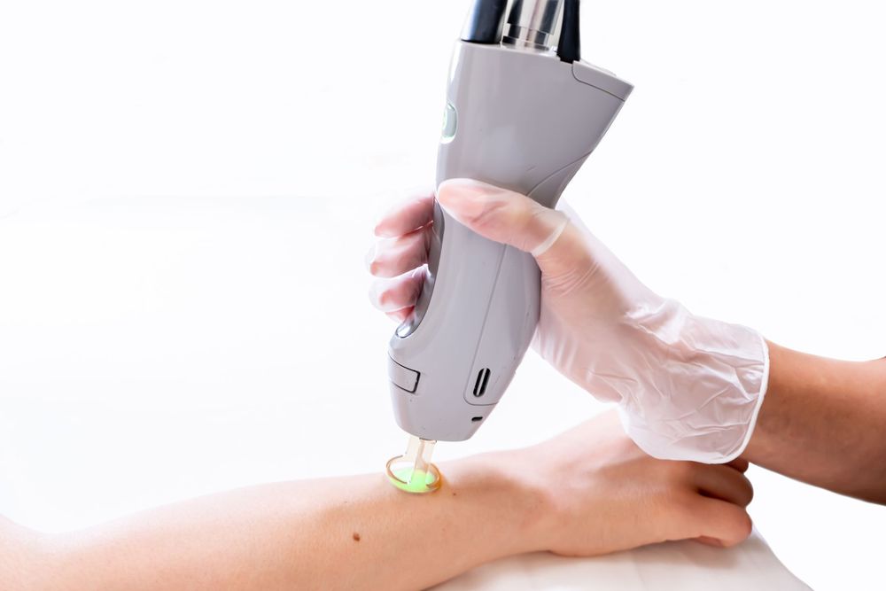 Common Laser Hair Removal Misconceptions to Not Worry About
