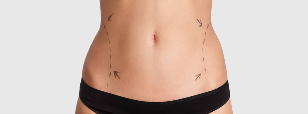 Liposuction in Austin, TX: Transform Your Body Today