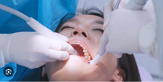 How Permanent Tooth Replacements Can Improve Your Oral Health